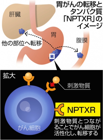 胃がんの転移とタンパク質「NPTXR」のイメージ